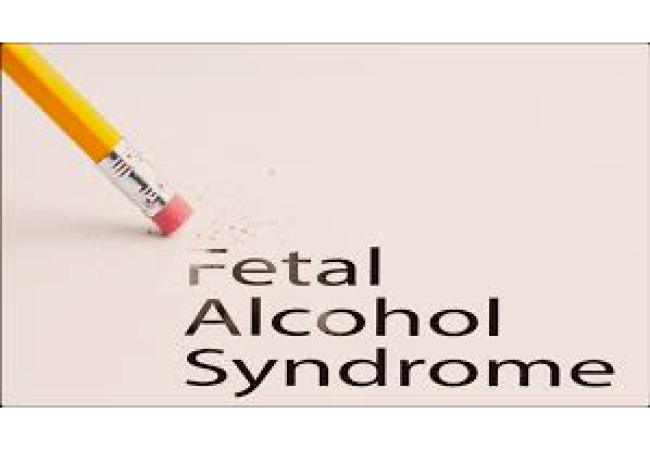 Fetal Alcohol Syndrome
